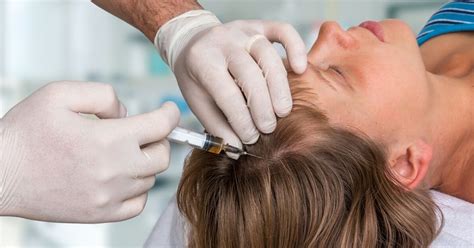 Wat Is Haartransplantatie En Hoe Werkt Het?