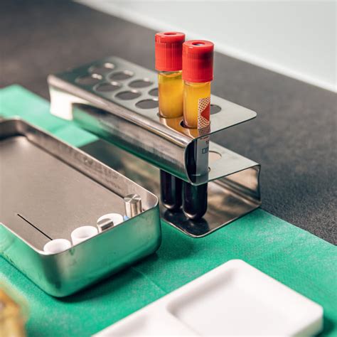 PRP Behandeling Voor Haar: Wat Is Het En Werkt Het?