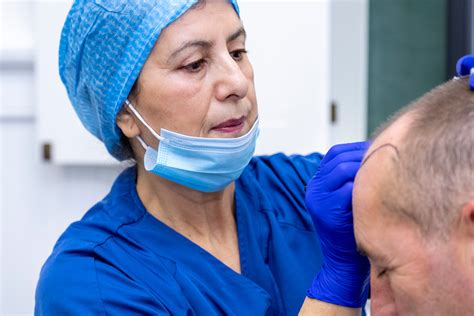De Techniek Achter Haartransplantatie Behandelingen